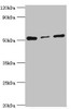 Western blot<br />
 All lanes: Programmed cell death protein 4 antibody at 4µg/ml<br />
 Lane 1: Hela whole cell lysate<br />
 Lane 2: MCF-7 whole cell lysate<br />
 Lane 3: Jurkat whole cell lysate<br />
 Secondary<br />
 Goat polyclonal to rabbit IgG at 1/10000 dilution<br />
 Predicted band size: 52, 51 kDa<br />
 Observed band size: 52 kDa<br />