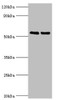 Western blot<br />
 All lanes: TRIM27 antibody at 4µg/ml<br />
 Lane 1: Jurkat whole cell lysate<br />
 Lane 2: HepG2 whole cell lysate<br />
 Secondary<br />
 Goat polyclonal to rabbit IgG at 1/10000 dilution<br />
 Predicted band size: 59, 42 kDa<br />
 Observed band size: 59 kDa<br />