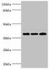 Western blot<br />
 All lanes: Twinfilin-2 antibody at 3µg/ml<br />
 Lane 1: Jurkat whole cell lysate<br />
 Lane 2: HepG2 whole cell lysate<br />
 Lane 3: A431 whole cell lysate<br />
 Secondary<br />
 Goat polyclonal to rabbit IgG at 1/10000 dilution<br />
 Predicted band size: 40 kDa<br />
 Observed band size: 40 kDa<br />
