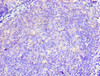 Immunohistochemistry of paraffin-embedded human tonsil tissue using CSB-PA764224ESR1HU at dilution of 1:100