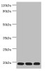 Western blot<br />
 All lanes: Thioredoxin, mitochondrial antibody at 3µg/ml<br />
 Lane 1: Mouse liver tissue<br />
 Lane 2: Rat brain tissue<br />
 Lane 3: Mouse kidney tissue<br />
 Secondary<br />
 Goat polyclonal to rabbit IgG at 1/10000 dilution<br />
 Predicted band size: 18 kDa<br />
 Observed band size: 18 kDa<br />