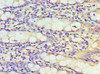 Immunohistochemistry of paraffin-embedded human colon tissue using CSB-PA857458ESR2HU at dilution of 1:100