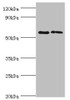 Western blot<br />
 All lanes: Alkaline phosphatase, placental type antibody at 6µg/ml<br />
 Lane 1: A549 whole cell lysate<br />
 Lane 2: Hela whole cell lysate<br />
 Secondary<br />
 Goat polyclonal to rabbit IgG at 1/10000 dilution<br />
 Predicted band size: 58 kDa<br />
 Observed band size: 58 kDa<br />