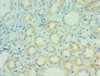 Immunohistochemistry of paraffin-embedded human kidney tissue using CSB-PA001458ESR2HU at dilution of 1:100