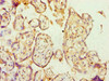 Immunohistochemistry of paraffin-embedded human placenta tissue using CSB-PA001869ESR1HU at dilution of 1:100