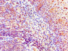 Immunohistochemistry of paraffin-embedded human tonsil tissue using CSB-PA883363ESR1HU at dilution of 1:100