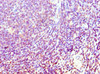 Immunohistochemistry of paraffin-embedded human tonsil tissue using CSB-PA861988ESR2HU at dilution of 1:100