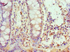 Immunohistochemistry of paraffin-embedded human colon tissue using CSB-PA861988ESR2HU at dilution of 1:100