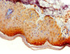 Immunohistochemistry of paraffin-embedded human skin tissue using CSB-PA741052ESR2HU at dilution of 1:100