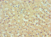 Immunohistochemistry of paraffin-embedded human liver tissue using CSB-PA001545ESR1HU at dilution of 1:100