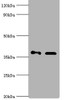 Western blot<br />
 All lanes: Aldo-keto reductase family 1 member C4 antibody at 7µg/ml<br />
 Lane 1: Hela whole cell lysate<br />
 Lane 2: HepG 2 whole cell lysate<br />
 Secondary<br />
 Goat polyclonal to rabbit IgG at 1/10000 dilution<br />
 Predicted band size: 37 kDa<br />
 Observed band size: 37 kDa<br />