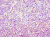 Immunohistochemistry of paraffin-embedded human tonsil tissue using CSB-PA001545ESR2HU at dilution of 1:100