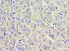 Immunohistochemistry of paraffin-embedded human placenta tissue using CSB-PA001176ESR2HU at dilution of 1:100