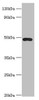 Western blot<br />
 All lanes: ACTR3B antibody at 8µg/ml + HepG2 whole cell lysate<br />
 Secondary<br />
 Goat polyclonal to rabbit IgG at 1/10000 dilution<br />
 Predicted band size: 48, 38, 40 kDa<br />
 Observed band size: 48 kDa<br />