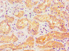 Immunohistochemistry of paraffin-embedded human kidney tissue using CSB-PA878955ESR2HU at dilution of 1:100