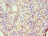 Immunohistochemistry of paraffin-embedded human pancreatic tissue using CSB-PA878955ESR2HU at dilution of 1:100