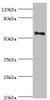 Western blot<br />
 All lanes: Tyrosine-protein kinase Blk antibody at 10µg/ml + Mouse kidney tissue<br />
 Secondary<br />
 Goat polyclonal to rabbit IgG at 1/10000 dilution<br />
 Predicted band size: 58 kDa<br />
 Observed band size: 58 kDa<br />