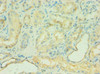 Immunohistochemistry of paraffin-embedded human kidney tissue using CSB-PA003954ESR2HU at dilution of 1:100