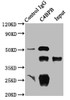 Immunoprecipitating C4BPB in HepG2 whole cell lysate<br />
 Lane 1: Rabbit control IgG instead of CSB-PA003954ESR2HU in HepG2 whole cell lysate.
 For western blotting, a HRP-conjugated Protein G antibody was used as the secondary antibody (1/2000) <br />
 Lane 2: CSB-PA003954ESR2HU (8µg) + HepG2 whole cell lysate (500µg) <br />
 Lane 3: HepG2 whole cell lysate (10µg) <br />