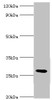 Western blot<br />
 All lanes: C4b-binding protein beta chain antibody at 6µg/ml + Mouse liver tissue<br />
 Secondary<br />
 Goat polyclonal to rabbit IgG at 1/10000 dilution<br />
 Predicted band size: 28 kDa<br />
 Observed band size: 28 kDa<br />