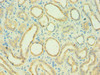 Immunohistochemistry of paraffin-embedded human kidney tissue using CSB-PA003954ESR1HU at dilution of 1:100