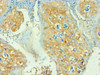 Immunohistochemistry of paraffin-embedded human tonsil tissue using CSB-PA004930ESR1HU at dilution of 1: 100