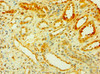 Immunohistochemistry of paraffin-embedded human kidney tissue using CSB-PA885721ESR1HU at dilution of 1:100