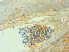 Immunohistochemistry of paraffin-embedded human tonsil tissue using CSB-PA006190ESR2HU at dilution of 1:100