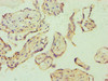 Immunohistochemistry of paraffin-embedded human placenta tissue using CSB-PA007347ESR2HU at dilution of 1:100