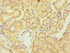 Immunohistochemistry of paraffin-embedded human pancreatic tissue using CSB-PA008597ESR1HU at dilution of 1:100