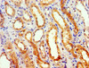 Immunohistochemistry of paraffin-embedded human kidney tissue using CSB-PA009362ESR2HU at dilution of 1:100