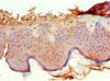 Immunohistochemistry of paraffin-embedded human skin tissue using CSB-PA019047DSR1HU at dilution of 1:100