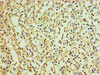 Immunohistochemistry of paraffin-embedded human spleen tissue using CSB-PA836205ESR2HU at dilution of 1:100