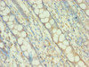 Immunohistochemistry of paraffin-embedded human colon tissue using CSB-PA890743ESR1HU at dilution of 1:100