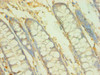 Immunohistochemistry of paraffin-embedded human colon tissue using CSB-PA002601ESR1HU at dilution of 1:100