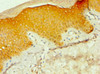 Immunohistochemistry of paraffin-embedded human skin tissue using CSB-PA839816ESR1HU at dilution of 1:100