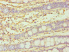 Immunohistochemistry of paraffin-embedded human colon tissue using CSB-PA006441ESR2HU at dilution of 1:100