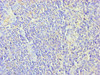 Immunohistochemistry of paraffin-embedded human tonsil tissue using CSB-PA026691ESR1HU at dilution of 1:100