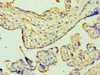 Immunohistochemistry of paraffin-embedded human placenta tissue using CSB-PA026691ESR1HU at dilution of 1:100