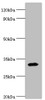 Western blot<br />
 All lanes: Zinc finger protein 346 antibody at 3µg/ml + Mouse brain tissue<br />
 Secondary<br />
 Goat polyclonal to rabbit IgG at 1/10000 dilution<br />
 Predicted band size: 33, 36, 30 kDa<br />
 Observed band size: 33 kDa<br />