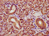 IHC image of CSB-PA026290ESR2HU diluted at 1:173 and staining in paraffin-embedded human pancreatic tissue performed on a Leica BondTM system. After dewaxing and hydration, antigen retrieval was mediated by high pressure in a citrate buffer (pH 6.0) . Section was blocked with 10% normal goat serum 30min at RT. Then primary antibody (1% BSA) was incubated at 4°C overnight. The primary is detected by a biotinylated secondary antibody and visualized using an HRP conjugated SP system.