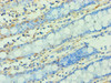 Immunohistochemistry of paraffin-embedded human colon tissue using CSB-PA026133ESR1HU at dilution of 1:100