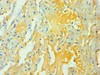 Immunohistochemistry of paraffin-embedded human lung tissue using CSB-PA026133ESR1HU at dilution of 1:100