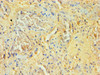 Immunohistochemistry of paraffin-embedded human lung tissue using CSB-PA022389ESR2HU at dilution of 1:100