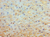 Immunohistochemistry of paraffin-embedded human esophagus tissue using CSB-PA009890ESR2HU at dilution of 1:100