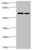 Western blot<br />
 All lanes: Myotubularin-related protein 14 antibody at 10µg/ml<br />
 Lane 1: Hela whole cell lysate<br />
 Lane 2: Mouse skeletal muscle tissue<br />
 Secondary<br />
 Goat polyclonal to rabbit IgG at 1/10000 dilution<br />
 Predicted band size: 73, 67, 61 kDa<br />
 Observed band size: 73 kDa<br />