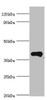 Western blot<br />
 All lanes: Phytanoyl-CoA dioxygenase, peroxisomal antibody at 4µg/ml + Mouse liver tissue<br />
 Secondary<br />
 Goat polyclonal to rabbit IgG at 1/10000 dilution<br />
 Predicted band size: 39, 28 kDa<br />
 Observed band size: 39 kDa<br />