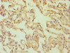 Immunohistochemistry of paraffin-embedded human lung tissue using CSB-PA001566ESR1HU at dilution of 1:100