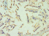 Immunohistochemistry of paraffin-embedded human prostate tissue using CSB-PA883647ESR1HU at dilution of 1:100