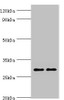 Western blot<br />
 All lanes: Spindlin-2B antibody at 4µg/ml<br />
 Lane 1: Mouse liver tissue<br />
 Lane 2: Mouse heart tissue<br />
 Secondary<br />
 Goat polyclonal to rabbit IgG at 1/10000 dilution<br />
 Predicted band size: 29 kDa<br />
 Observed band size: 29 kDa<br />